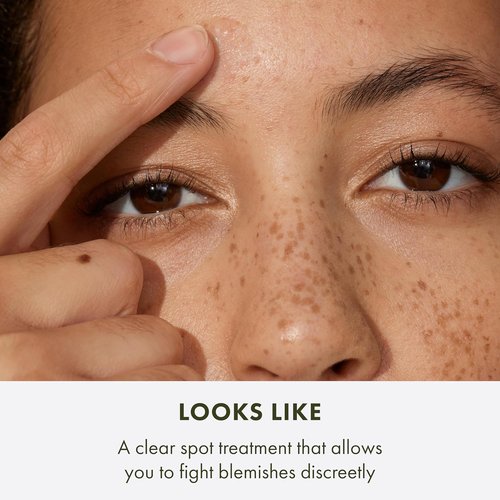 Origins Super Spot Treatment for Acne - Treats & Prevents Blemishes with Salicylic Acid | 0.3 Fl Oz