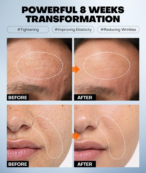 Radiant Glow Collagen Face Mask - Real Deep Overnight Face Masks Skincare with Hyaluronic Acid, Galactomyces Ferment & Vitamin E, Facial Mask for Hydrating, Firming, Plumping & Anti-Aging - 34g x 5ea