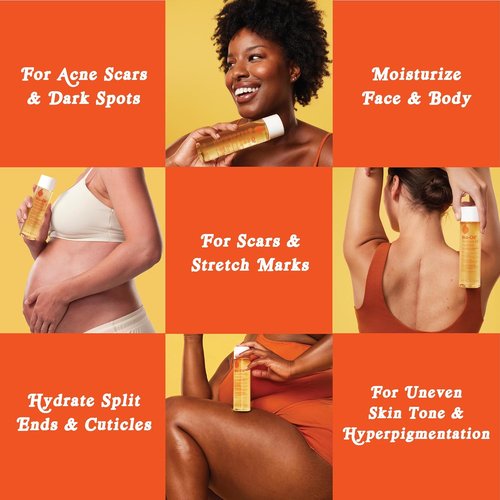 Bio-Oil Natural Skincare Oil - Serum for Scars & Stretch Marks | Moisturizer for All Skin Types, 4.2 Oz