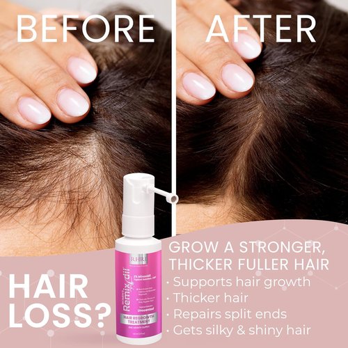 Regine Switzerland 2% Minoxidil Hair Regrowth Spray - Clinically Proven Solution for Thicker, Fuller Hair - 60 ml