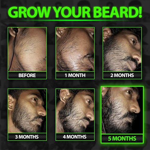 Beard Growth Serum by GROW | Maximum XXL Beard Oil for Men - Thickens & Fills Patches