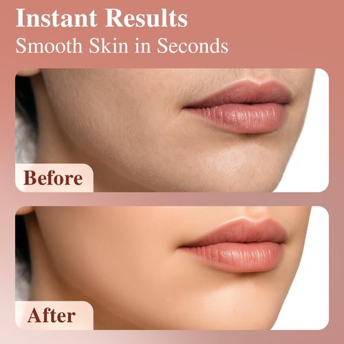 Facial Hair Removal for Women | Upper Lip Mustache Remover Device Face Shaver Woman Chin Peach Fuzz Electric Trimmer Dermaplane Female Razor Ladies Tweezers Lady Epilator Girls by VISOFO (White)