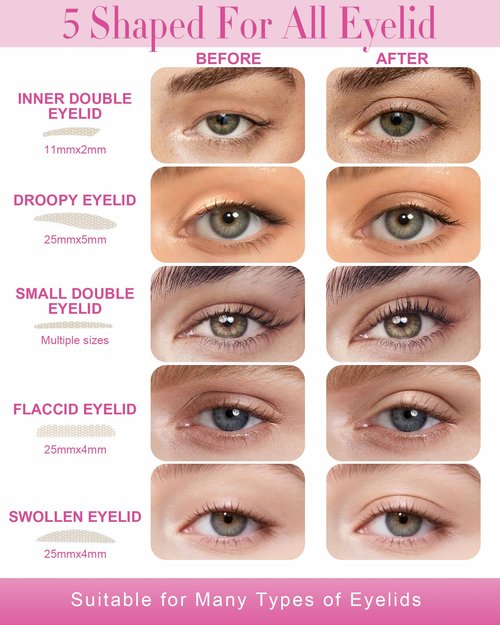 EMEDA Double Eyelid Tape 5 Sizes 700PCS Instant Lift Strips Invisible Natural Breathable Waterproof for Hooded Droopy Heavy Single Uneven Eyelids Ultra-Thin, Strong Hold(01)