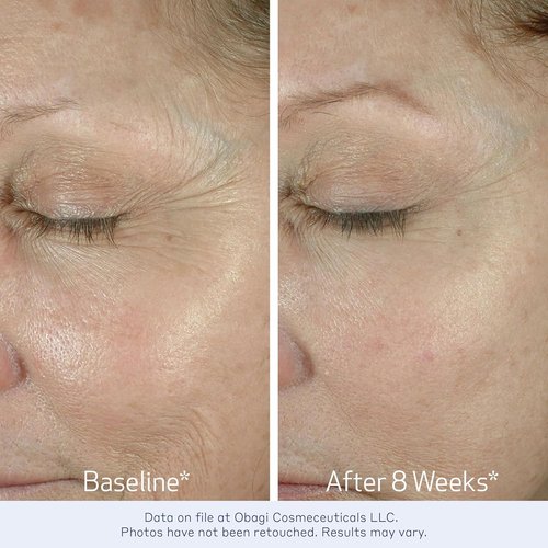 Obagi ELASTIderm Eye Cream - Lightweight Formula Clinically Proven to Reduce Fine Lines & Wrinkles