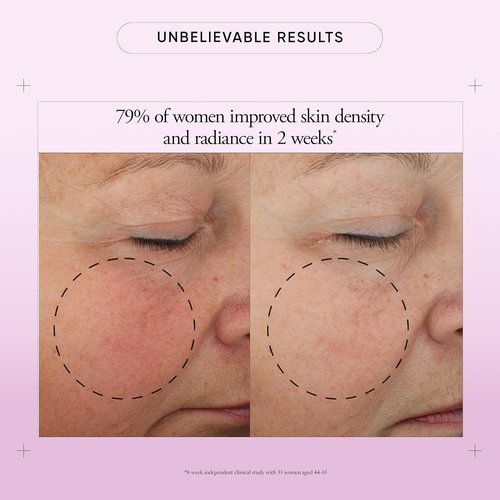 Philosophy Ultimate Miracle Worker Face Moisturizer Cream | SPF 30, Encapsulated Retinol for Youthful Skin - 2 Fl Oz