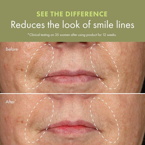 Origins Plantscription Anti-Aging Serum - Visibly Reduces Wrinkles | Gentle Retinoid & Peptide Formula