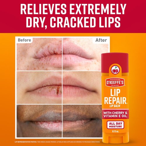 O'Keeffe's Lip Repair Lip Balm - Cherry & Vitamin E Oil - 3 Pack for Extremely Cracked, Dry Lips