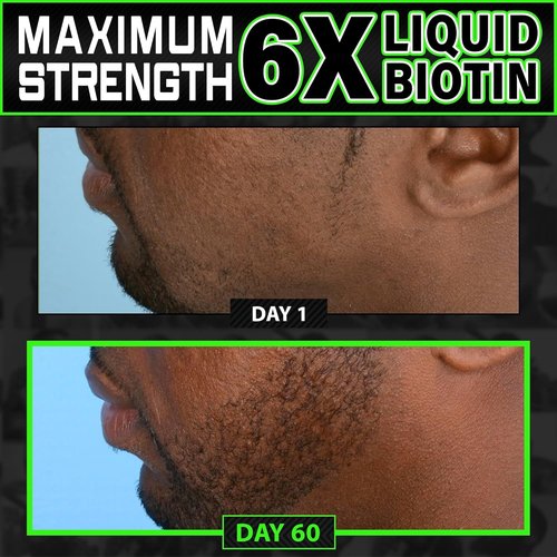 Skiennix Beard Growth Kit - 2X Thickening Biotin Balm & Conditioner + 6X Liquid Biotin with Collagen Peptides for Enhanced Beard & Hair Growth