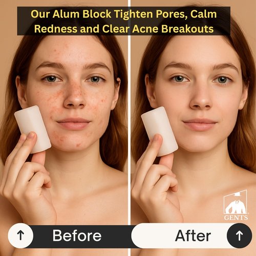 Gents Alum Block in Plastic Case | Upgrade Your Shave - Soothing Aftershave Solution for Shaving Razor Burn Relief - Travel Friendly Durable Plastic Case Included (3.5 Ounces Pack of 3)