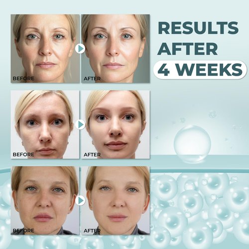 ABERA Anti-Wrinkle Face Cream, Anti-Aging Moisturizer for Fine Lines & Wrinkles, Hydrating Face Cream for Sensitive Skin, 0.7oz