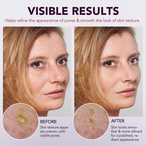 Peel Shot Glow Rice Ampoule Duo | Black Rice Exfoliant Face and Pore Cleaner with Hyaluronic Acid & Rice Extract Serum | Facial Pore Exfoliator, Peelshot Blackhead Dead Skin Remover for Face (100ml)