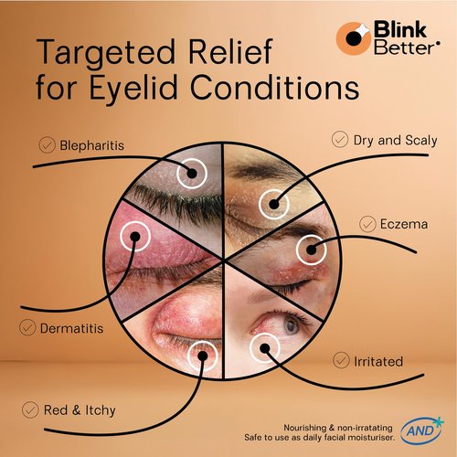 BlinkBetter BetterLids Restore Eyelid Cream – Barrier Support to Hydrate, Soothe & Moisturise Dry, Itchy, Red & Sensitive Eyelids – Lightweight Daily Formula with 3% Oat & Ceramides, 1 fl oz
