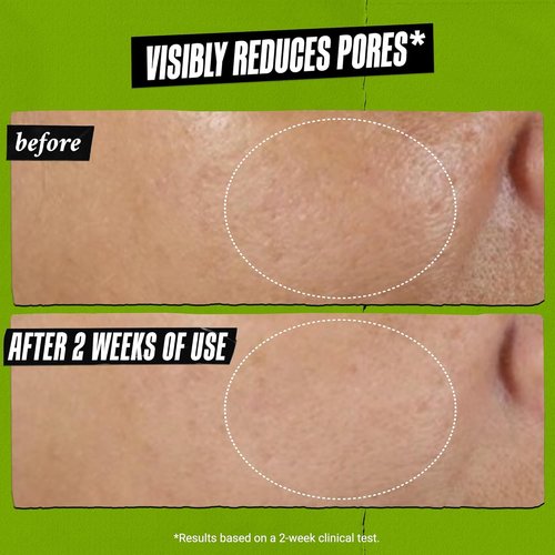 Kiehl's Rare Earth Deep Pore Cleansing Face Mask - Detoxifying Clay Mask for Blackhead & Acne Control