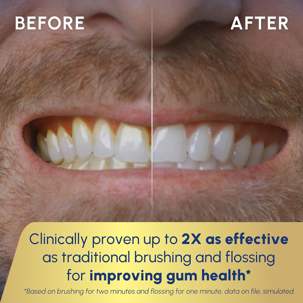 Waterpik Sonic-Fusion 2.0 Electric Toothbrush - 2-in-1 Flossing & Gum Care for Braces & Implants