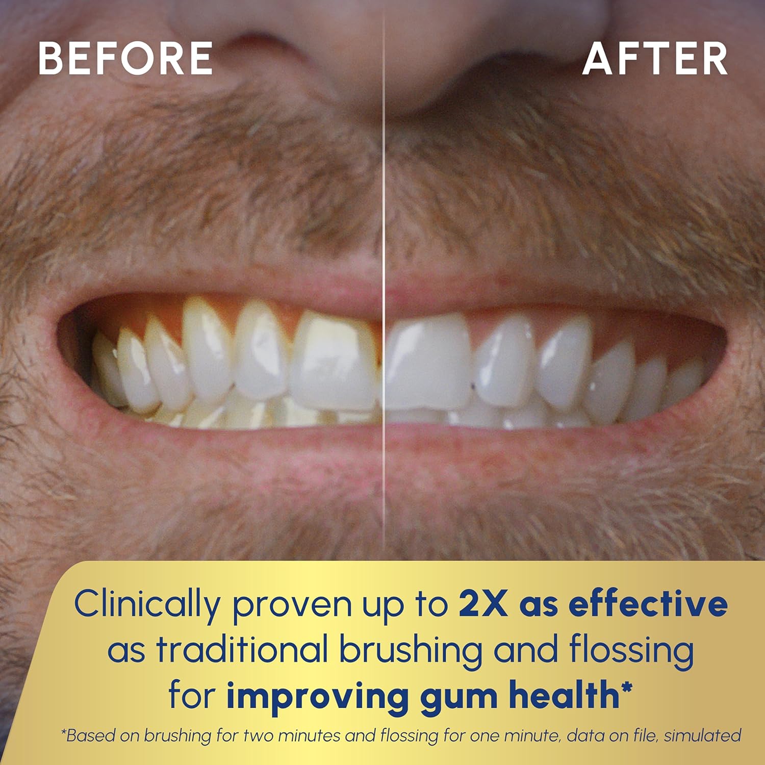 Waterpik Sonic-Fusion 2.0 Electric Toothbrush - 2-in-1 Flossing & Gum Care for Braces & Implants