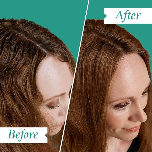 Philip Kingsley Moisture Balancing Shampoo & Conditioner Set - Hydrating for All Hair Types, 8.5 oz
