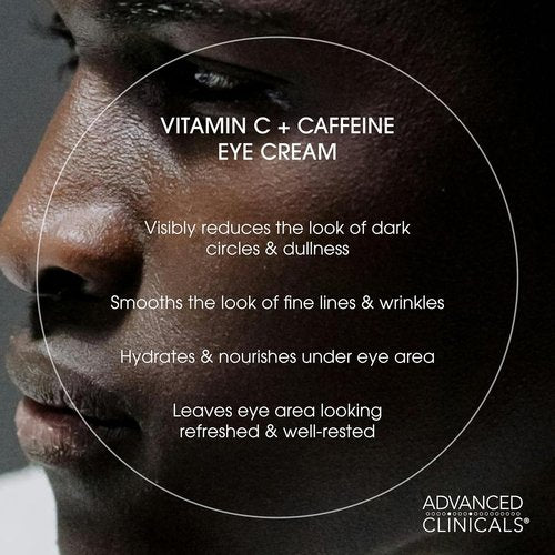 Advanced Clinicals Vitamin C + Caffeine Eye Balm - Under Eye Cream for Dark Circles & Puffiness, 1 Fl Oz