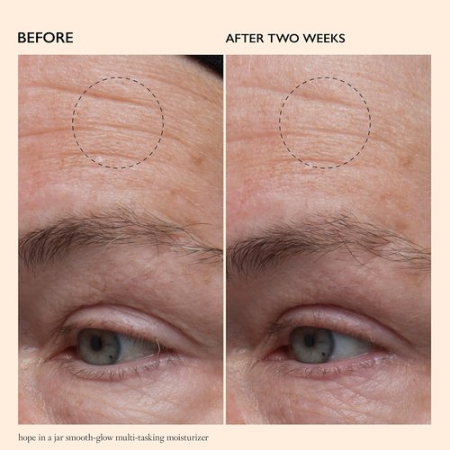 Philosophy Hope In A Jar Multi-Tasking Face Moisturizer With SPF 30 | Pro-Vitamin P & Glycolic Acid - 2 Fl Oz