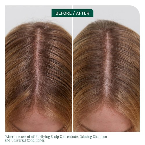 Biolage Scalp Sync Universal Conditioner - Nourishing Hydration for All Scalp Types | Lightweight & Vegan