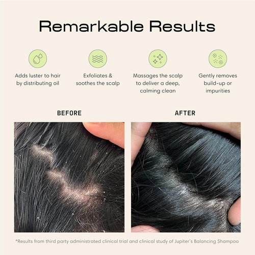 Jupiter Scalp Exfoliator - Ergonomic Scalp Massager & Dandruff Comb - Black/White Design for Healthy Hair