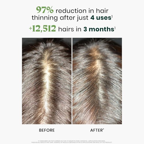 Rene Furterer Triphasic Concentrated Serum | Drug-Free Solution for Thinning Hair - 3-Month Supply