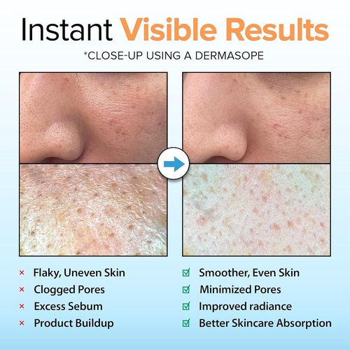 Ebanel Brightening Peeling Gel - Gentle Exfoliating Face & Body Scrub with Hyaluronic Acid | Deep Pore Cleanser