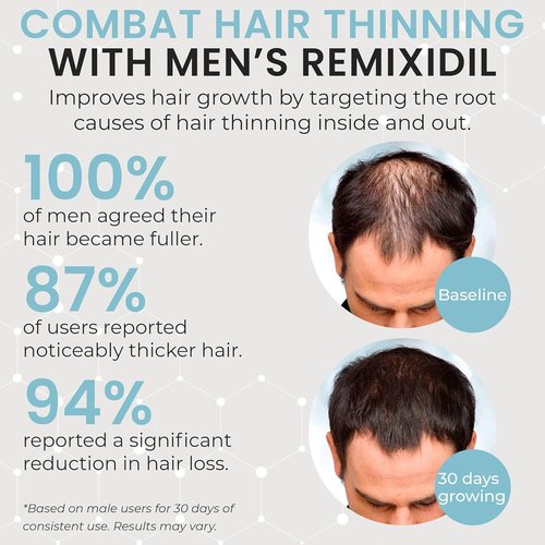 Hair Growth Vitamins - Regrow Hair For Men | Strengthen Beard & Scalp | Reduce Thinning & Breakage | Fast-Acting 60 Capsules