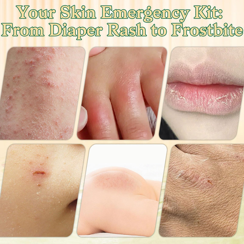 Whipped Beef Tallow Balm for Skin - 100% Organic Grass-Fed Tallow & Honey Body Butter, Infused with Olive Oil to Nourish, Soothe & Repair Dry, Cracked, Sensitive Skin- Natural Deep Moisturizer 4 OZ