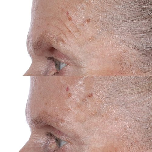 Perricone MD High Potency Face Finishing Toner - Firming & Hydrating Formula | 4 Fl. Oz.