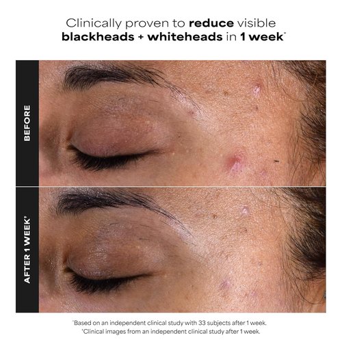 Paula's Choice SKIN PERFECTING 2% BHA Exfoliating Pads - Target Blackheads, Pores & Wrinkles