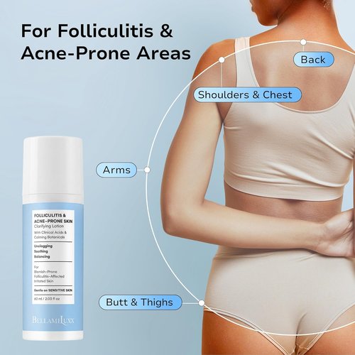 BellamiLuxx Folliculitis Acne Lotion - Soothes Itch & Redness, Reduces Body Acne & Bumps | Salicylic & Glycolic Acid + Botanicals