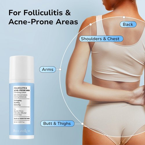 BellamiLuxx Folliculitis Acne Lotion for Body: Helps Reduce Itch, Redness, Body Acne, Bumps & Uneven Texture with Salicylic & Glycolic Acid + Botanicals - Gentle Care for Folliculitis-Prone Skin