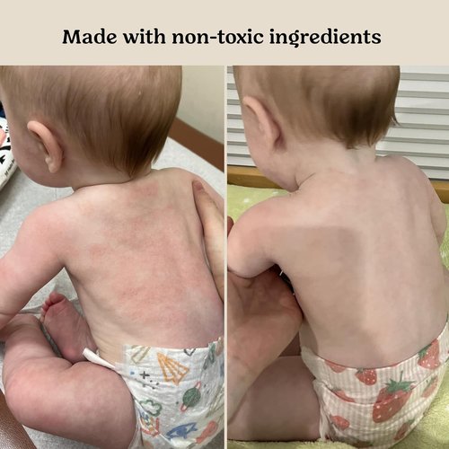 Roe Wellness Baby Cream & Serum Power Pair - Hydrating Skincare for All Ages | For Dry, Irritated Skin