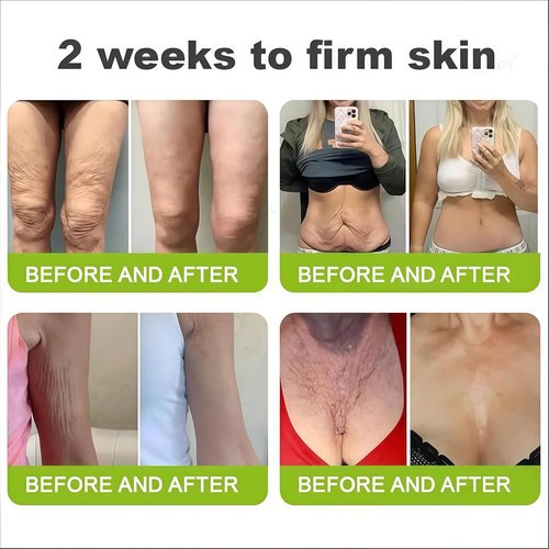 Botoxmix Wrinkle-Lift Tightening Cream - Anti-Aging, Pore Minimizer for All Skin Types (2 PCS)