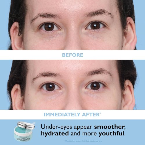Peter Thomas Roth | Vitamin C & Hyaluronic Eye Patches - Full-Size 2-Piece Kit for Brightening & Hydration