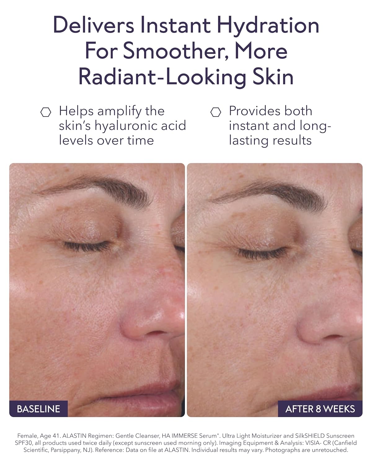 ALASTIN Skincare Hyaluronic Acid Face Serum - Restorative Moisturizer for Radiant Skin (1 oz)