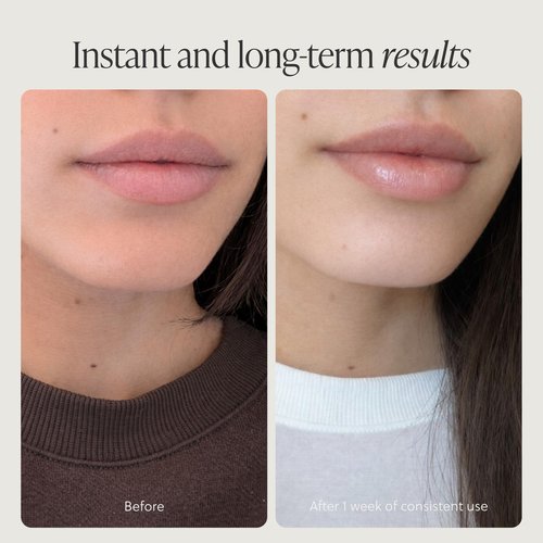 TALOVA - Grass-Fed Tallow Lip Balm, Lip Sleeping Mask, Overnight Moisturizer, Natural & Clean Moisturizing Lip Balm Vitamins A, D, E, & K, Nourishes and Smooths Dry & Chapped Lip (Peppermint)