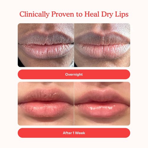 Tower 28 LipSoftie Tinted Lip Balm Treatment - Hydrating Glossy Balm & Overnight Mask with Jojoba Oil - Watermelon Kiwi (0.38 oz)