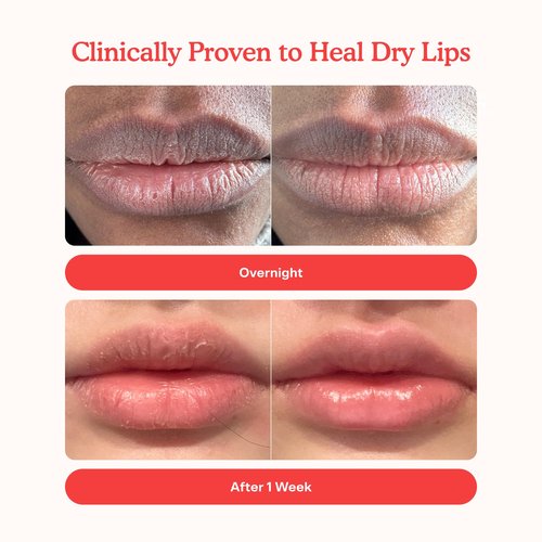 Tower 28 LipSoftie Tinted Lip Balm Treatment - Hydrating Glossy Balm + Overnight Lip Mask with Jojoba Oil + Shea Butter - Sweet, Cushiony Formula for Smooth, Soft Lips - Watermelon Kiwi (0.38 oz)