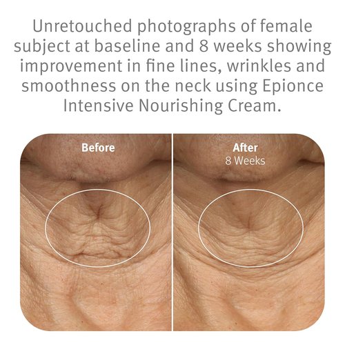 Epionce Intensive Nourishing Cream - Rich Anti-Aging Moisturizer for Face, Neck & Décolletage | Hydrates with Ceramides, Glycerin & Squalene | Reduces Fine Lines & Dark Spots