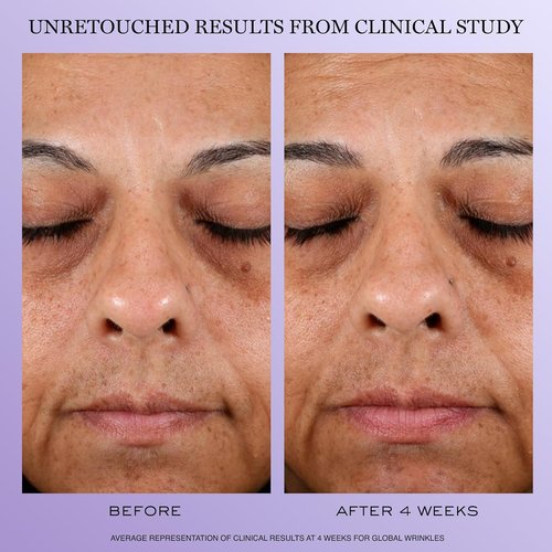 Lancôme Rénergie H.C.F. Triple Serum & H.P.N. 300-Peptide Face Cream Duo - Firm & Brighten Skin, 1.7 oz