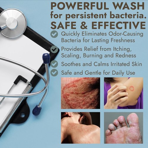 Antibacterial Body Wash by [Brand Name] - Kills 99.9% of Germs | Manuka Honey & Charcoal, 16 fl oz