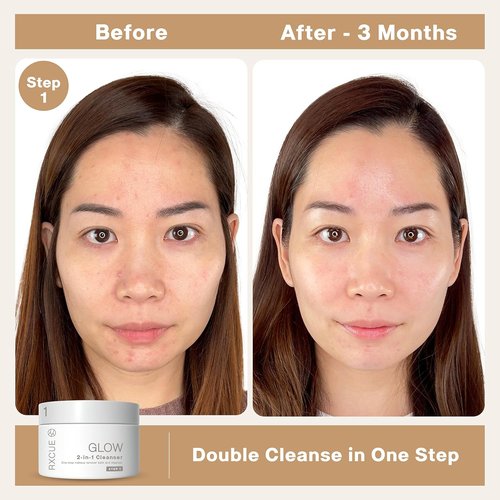 Rxcue Korean Skincare Set - 3-Step Travel Size K-Beauty Kit for Glass Skin | TSA Approved, 1.01 fl oz Each