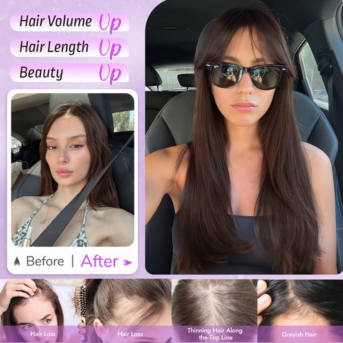 Eawwii Hair Topper for Women Clip in Bangs – 18 Inch Medium Length Straight 360° Full Coverage Dark Brown,Synthetic Natural Looking Piece for Thinning Hair