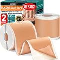 Aheroi Silicone Scar Tape, 1.6"x200" Silicone Scar Sheets(2 Rolls-5M)Medical Grade Scar Sheets for Surgical Scars, Soft Scar Patches Reusable Scar Removal Strips,Effective C-Section Keloid Tummy Treat