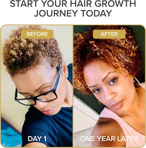 Shedavi Iconic Natural Hair Vitamins - Fast Hair Growth & Thicker Hair | Vegan Supplements (60 Capsules)