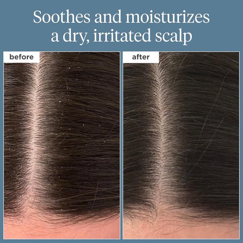 Briogeo Scalp Revival Rosemary Pre-Wash Oil - Moisturizing Treatment for Dry, Flaky Scalp | Strengthens Hair & Soothes | Vegan & Cruelty-Free