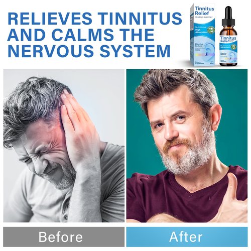 Tinnitus Relief for Ringing Ears, Natural Ingredients Tinnitus Ear Ringing Relief, Effective Tinnitus Treatment to Reduce Ear Noise & Improve Hearing for Men & Women