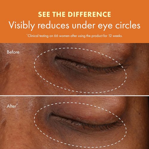 Origins GinZing Brightening Eye Cream - Vitamin C & Niacinamide for Dark Circles | 0.5 Fl Oz
