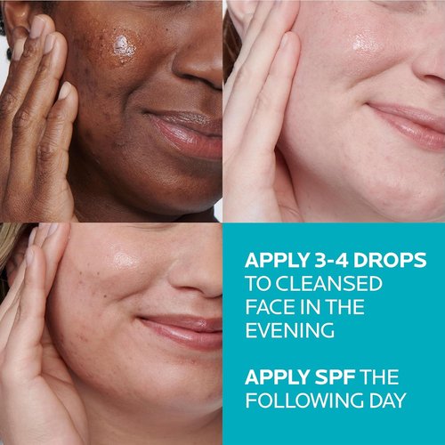 La Roche-Posay Effaclar Acne Serum - 1.5% Salicylic Acid Treatment with Glycolic Acid & Niacinamide